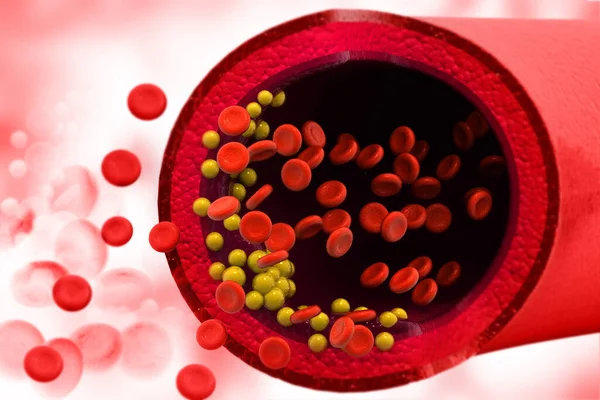 Cholesterol Plaque Blood Vessel Medical Background Illustration — Stock Photo, Image