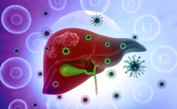 Infección Viral Hígado Humano Formación Médica Ilustración —  Fotos de Stock