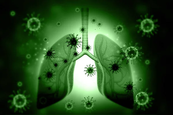 Lungs Disease Virus Bacteria Medical Background Illustration — Stock Photo, Image
