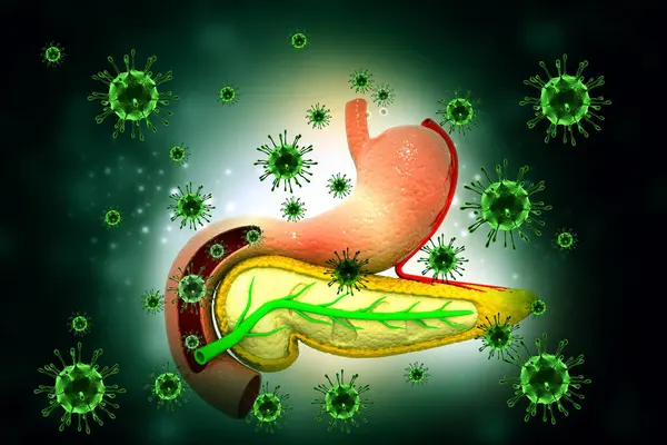 Virusinfektion Der Bauchspeicheldrüse Medizinischer Hintergrund Illustration — Stockfoto