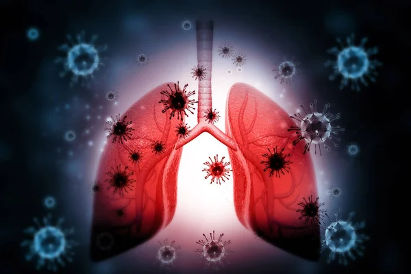 Lungsjukdom Med Virus Bakterier Läkarbakgrund Illustration — Stockfoto
