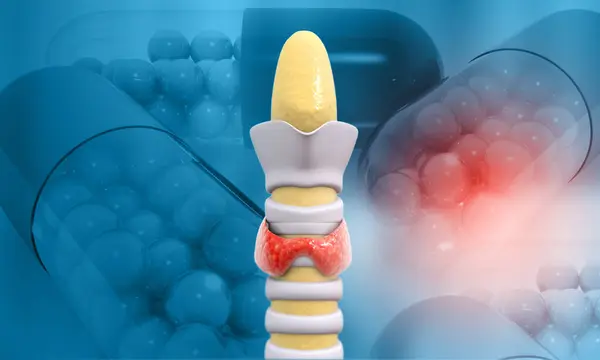 Щитовидная Железа Лекарством Гипертиреоз Иллюстрация — стоковое фото