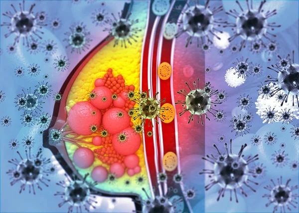 Virus Oorzaak Borstkanker Concept Achtergrond Illustratie — Stockfoto