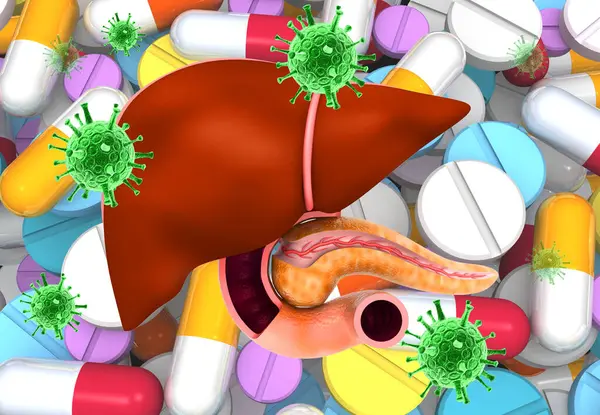 Medizinische Ernährungstherapie Bei Viraler Hepatitis Darstellung — Stockfoto