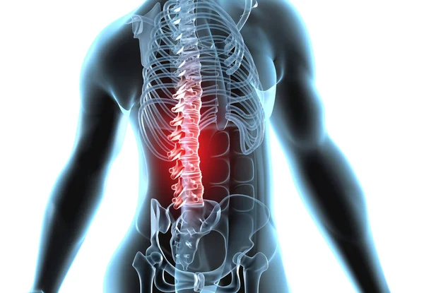 人体脊髄関節痛 人間の体の背中の痛み 3Dイラスト — ストック写真
