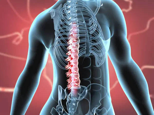 Concetto Lesione Spinale Illustrazione — Foto Stock