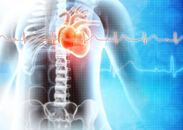 Ataque Cardíaco Humano Doença Cardíaca Ilustração — Fotografia de Stock