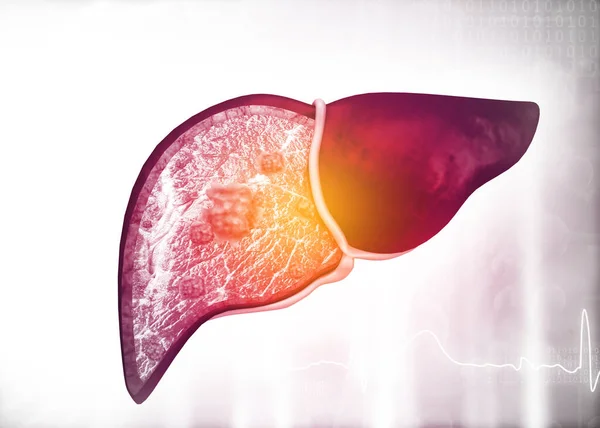Diseased human liver on science background. 3d illustration