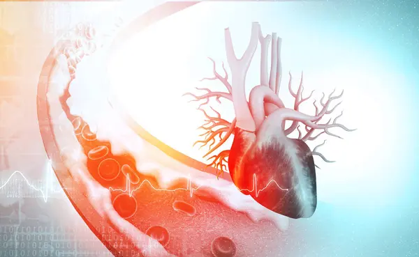 胆固醇以心脏阻断动脉 3D说明 — 图库照片