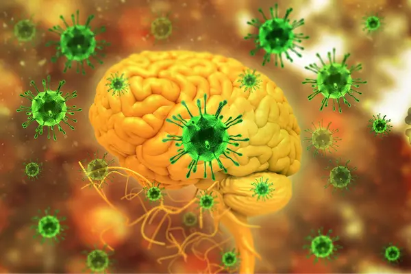Virus Infection Brain Illustration — Stock Photo, Image