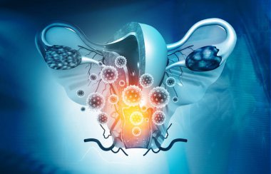 Rahim enfeksiyonu konsepti. 3d illüstrasyon