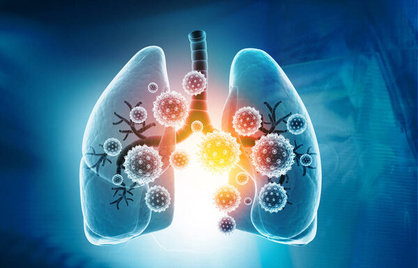 Viral lung infections, lung infection conept. 3d illustration	