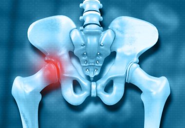 Kalça kemiği ya da pelvis ağrısı. 3d illüstrasyon