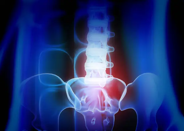 Human hip bone or pelvic pain. 3d illustration