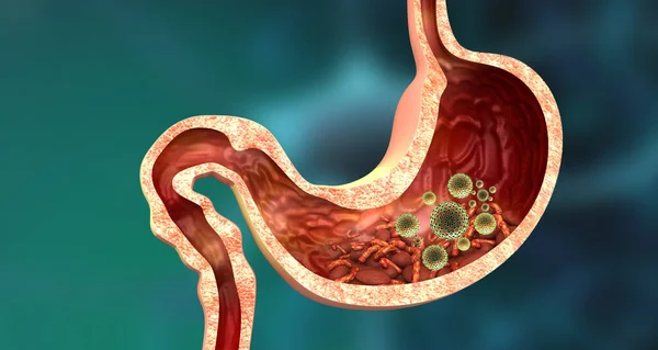 ウイルスやバクテリアによる人間の胃の断面 3Dイラスト — ストック写真