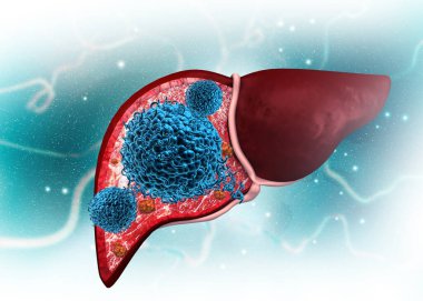 İnsan karaciğerine virüs saldırısı. 3d illüstrasyon