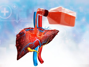 Karaciğerli alkol. Alkolik karaciğer hasarı. 3d illüstrasyon