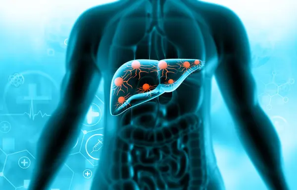 Virus Attack Human Liver Illustration — Stock Photo, Image