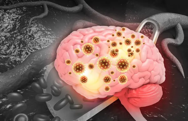 Virus Attacking Human Brain Illustration — Stock Photo, Image