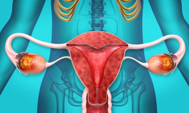 İnsan anatomisi kadın üreme sistemi, rahim ve yumurtalıklar. 3d illüstrasyon