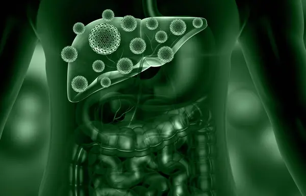 Virus Infected Human Liver Illustration — Stock Photo, Image