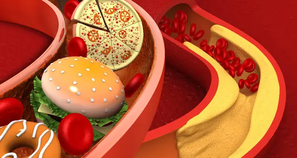 Unhealthy Junk Food Blocked Arteries Heart Illustration — Stock Photo, Image