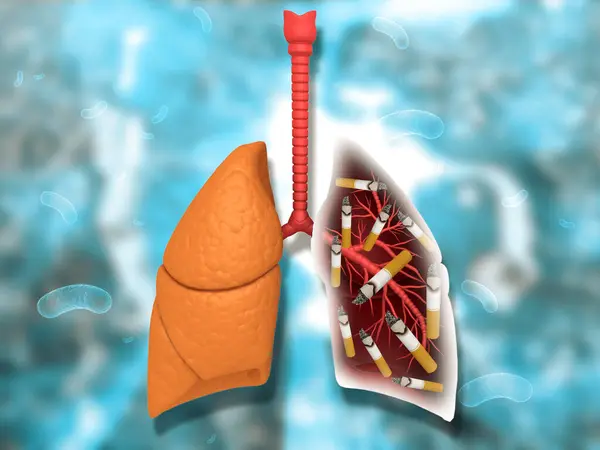 Pulmones Humanos Con Tabaco Triturado Ilustración — Foto de Stock