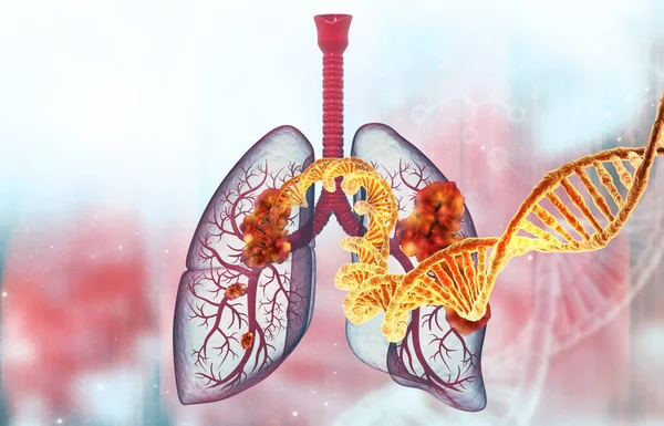 Cancro Polmoni Umano Con Filamento Dna Illustrazione — Foto Stock