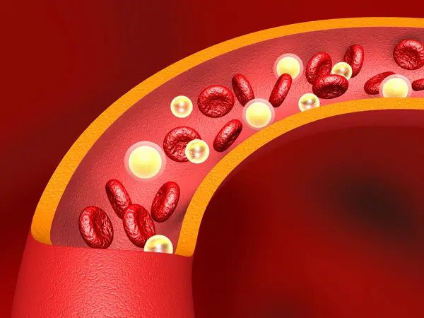 Ldl Cholesterol Arteries Illustration — Stock Photo, Image