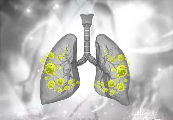 Virus Bacteria Human Lungs Illustration — Stock Photo, Image