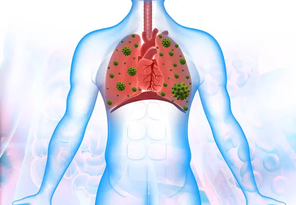 人体内 肺和心脏中的考罗那韦 3D说明 — 图库照片