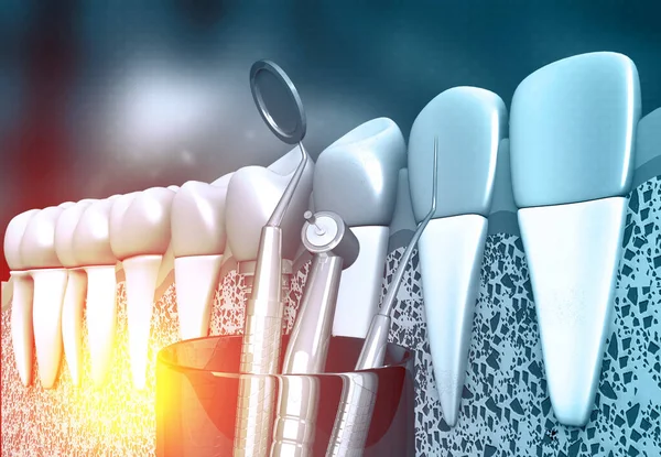 Людський Зуб Допомогою Зубних Інструментів Ілюстрація — стокове фото