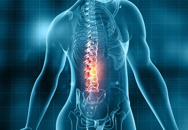 Human Spine Pain Illustration — Stok fotoğraf