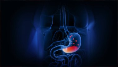 İnsan mide gazı sorunu kavramı. 3d illüstrasyon