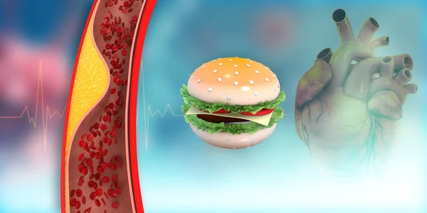 Blocked Arteries Junk Food Heart Illustration — Stock Photo, Image