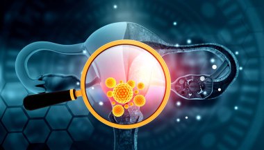 Büyüteç altında kadın rahmi enfeksiyonu. 3d illüstrasyon. 