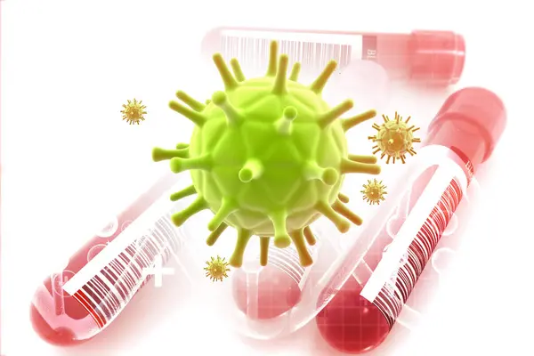 Kan Plazma Örnekleri Üzerinde Covid Virüsü Roman Coronavirus Antikor Testi — Stok fotoğraf