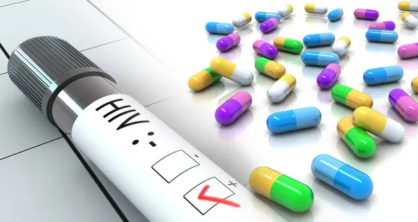 Hiv Test Positiv Mit Medikamentenpillen Illustration — Stockfoto