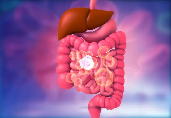 Sistema Digestivo Umano Con Batteri Virali Illustrazione — Foto Stock