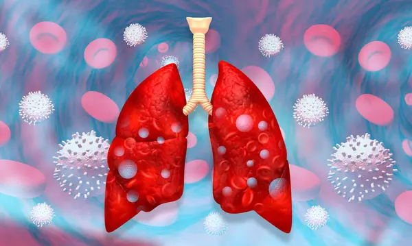 Pulmones Humanos Con Virus Corona Ilustración —  Fotos de Stock