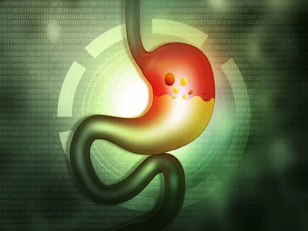 Stomach trouble. Medical background. 3d illustration