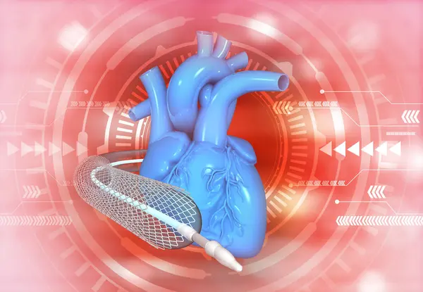 Ангиопластика Стент Человеческим Сердцем Иллюстрация — стоковое фото