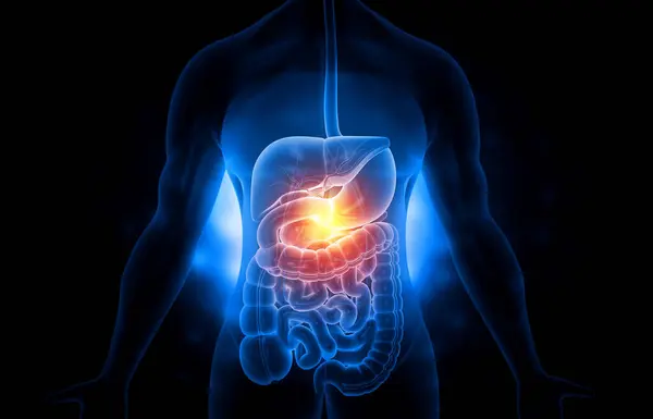 Problema Gástrico Del Sistema Digestivo Humano Ilustración — Foto de Stock