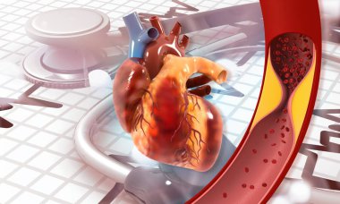 Kan damarı tıkanmış, atardamarda insan kalbi anatomisi var. 3d illüstrasyon