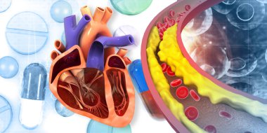 Atardamarda kolesterol plağı ve insan kalbi anatomisi. 3d illüstrasyon