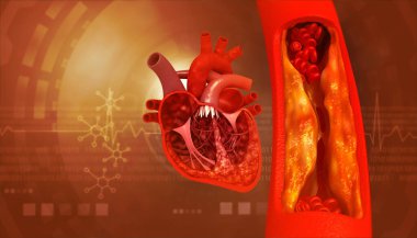 Kan damarı tıkanmış, atardamarda insan kalbi anatomisi var. 3d illüstrasyon