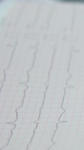 Ein Kardiologe Macht Dem Patienten Ein Kardiogramm Weibliche Hände Eines — Stockvideo