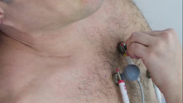 胸に吸着カップを付ける髪の胸を持つ男性のための心臓図を作る問題は 心臓図がテスト不便な技術デバイスを実施することは不可能になります 高品質で — ストック動画