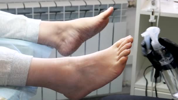在医院美容院进行清洁治疗前 准备用防腐喷雾消毒脚趾头进行足部修整治疗 戴黑色手套的专业医生 — 图库视频影像