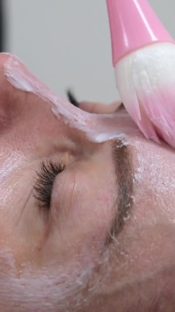 フェイシャル復活 医師は美しい注射をする前に 中年の女性の顔に麻酔クリームを適用します クローズアップ メソセラピーとバイオリバイタリゼーション 美容コンセプト 美容インジェクション 4Kについて — ストック動画